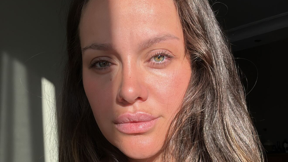 Ünlü oyuncu İrem Helvacıoğlu korkutan kazayı anlattı Ünlü oyuncu İrem Helvacıoğlu korkutan kazayı anlattı